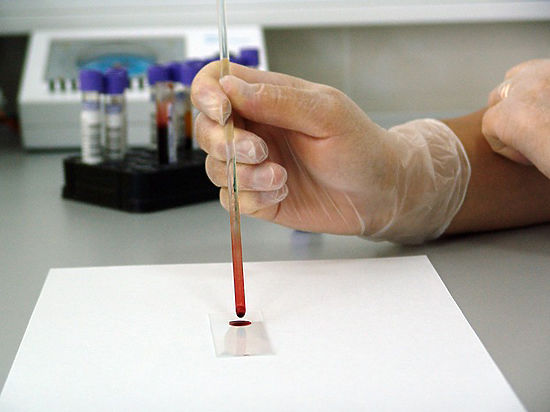В рамках диспансеризации предложат пройти тест на ВИЧ