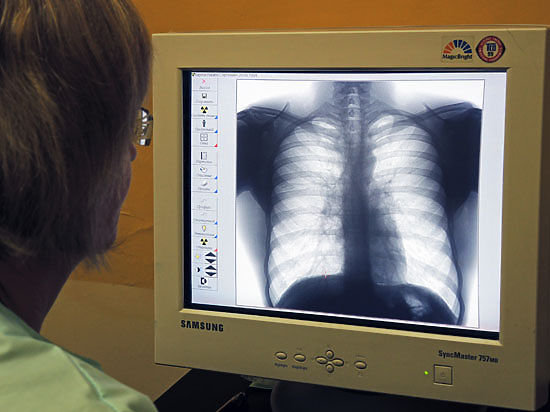 Среди обследованных методом спирометрии симптомы астмы обнаружены у каждого четвертого